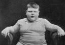 John Trunley - the Fat Boy of Peckham. 14 stones at the age of 6.