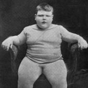 John Trunley - the Fat Boy of Peckham. 14 stones at the age of 6.