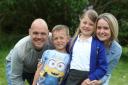 Chloe survived the operation in which she had her skull fractured into pieces and is now a healthy happy eight-year-old