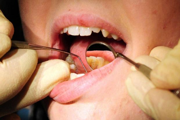 Fluoride in water 'improves children's dental health'